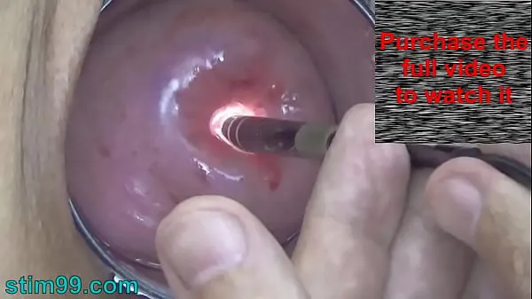 Große Endoskopische Kamera in Cervix Uhr in meinem Mutterleib und meiner Vagina. Inspektionstest Untersuchung der Frau durch einen extremen Gynäkologenwarme Röhre